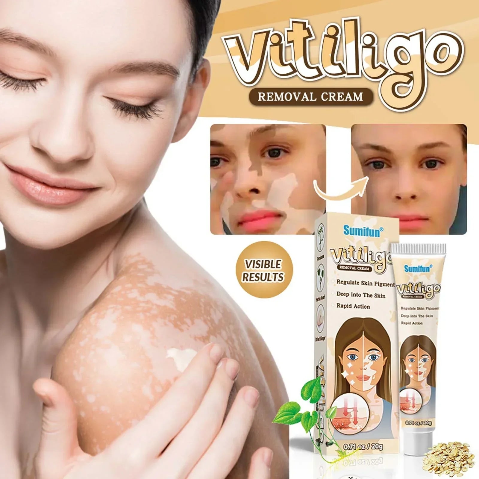 SUMIFUN VITILIGO CREMA ELIMINADORA 20g